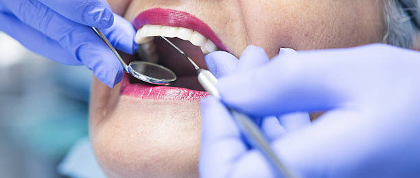 Best Emergency Wisdom Teeth Removal in Louisville, NE