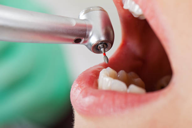 Best Same-Day Emergency Dental Services in Louisville, NE